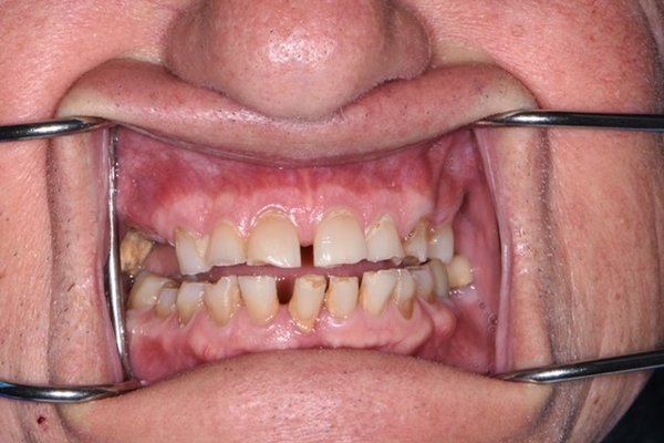 Before image