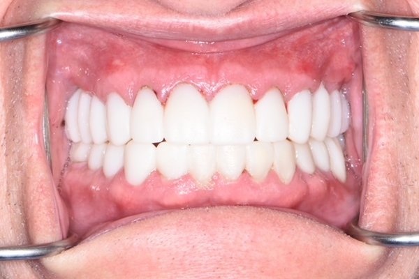 After image